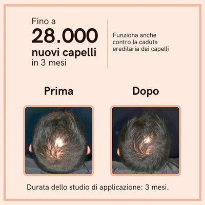 Capelli Set