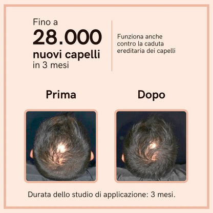 Capelli Set