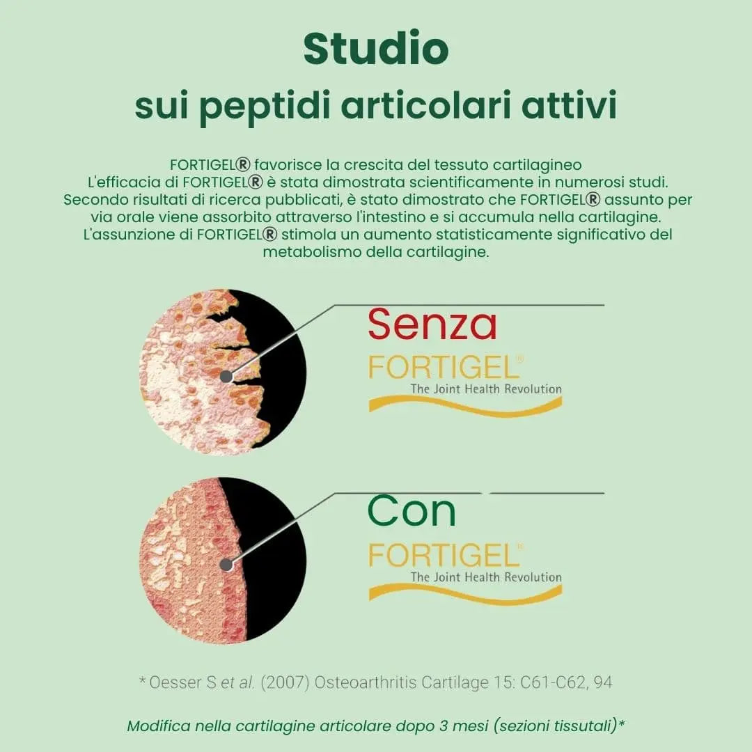 Sistema Cartilagine